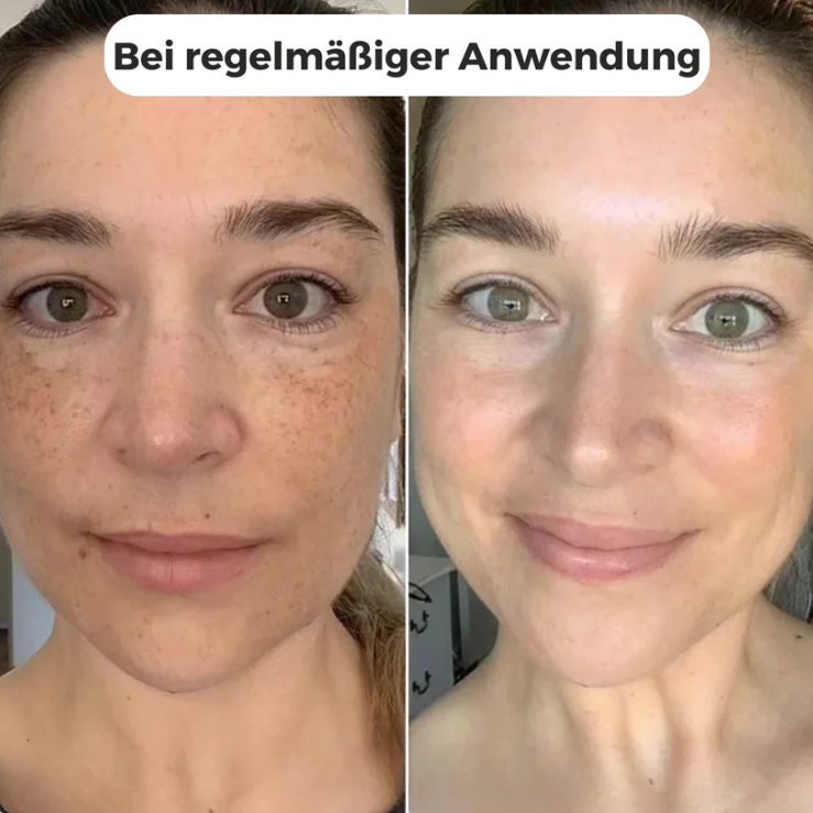 Bio-Kollagenmaske zur Hautverjüngung